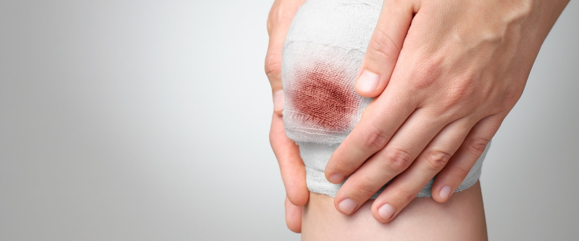 What Does a Healing Wound Smell Like? When to Worry About Recovery Scents