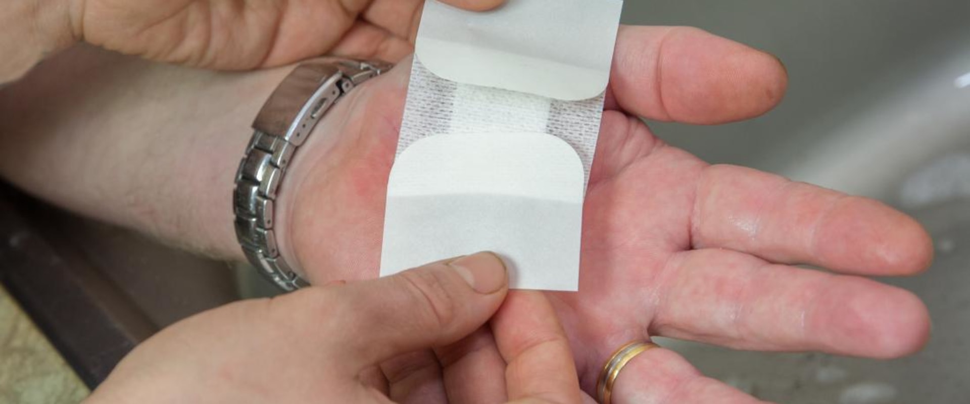 What Is Serosanguineous Drainage? Know What It Means & Why It Matters