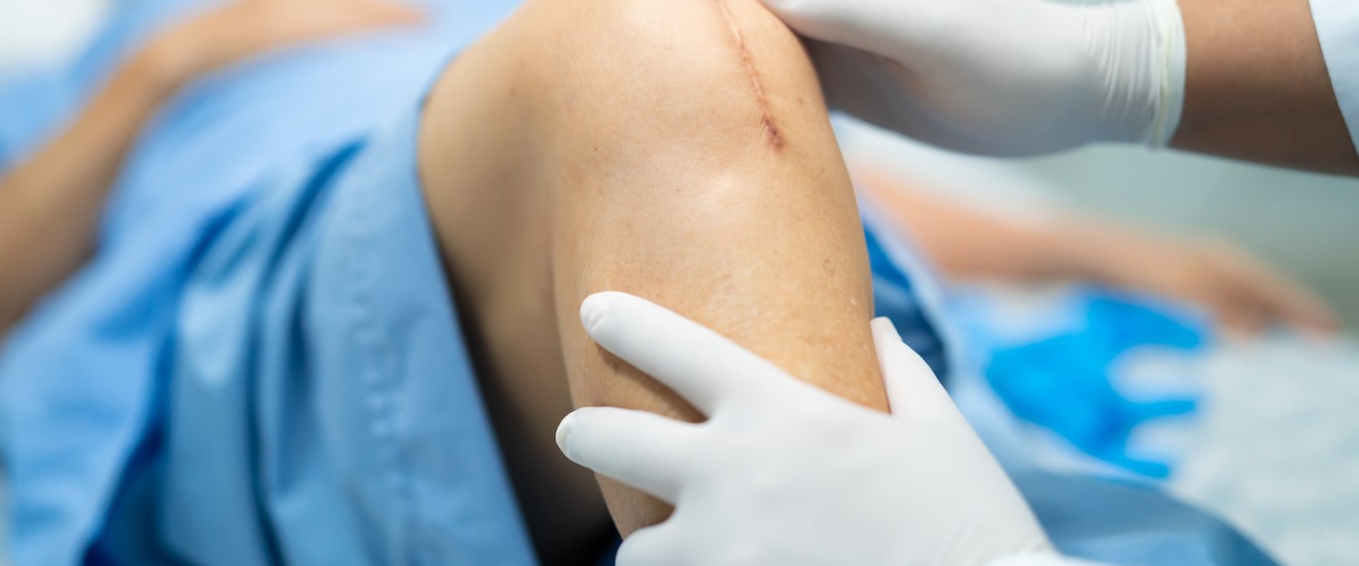 Dissolvable Stitches Healing Stages: See How Recovery Unfolds