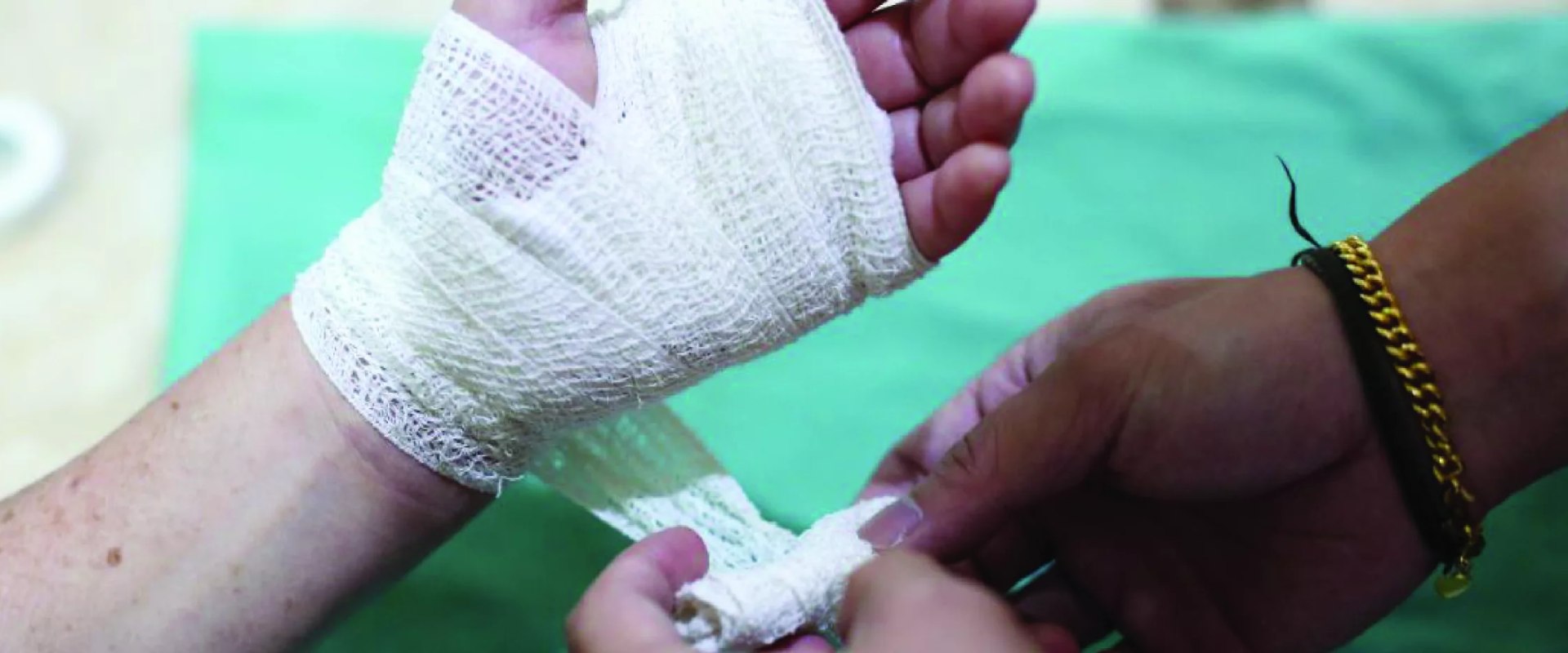 Iodoform Packing Benefits: Does It Really Speed Up Wound Healing?