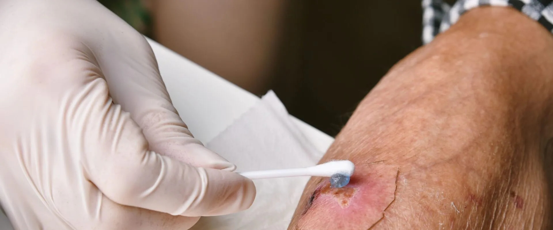 Do Antibiotics for Wound Infection Really Work? Safe Healing Tips