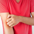 Is Itching a Sign of Healing or Infection? How to Tell If It’s Normal or If Your Recovery Needs Medical Attention