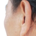 Boil vs Cyst vs Abscess: Quick Guide to Safe Care