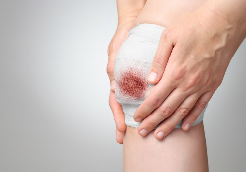 What Does a Healing Wound Smell Like? When to Worry About Recovery Scents
