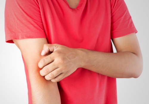 Is Itching a Sign of Healing or Infection? How to Tell If It’s Normal or If Your Recovery Needs Medical Attention