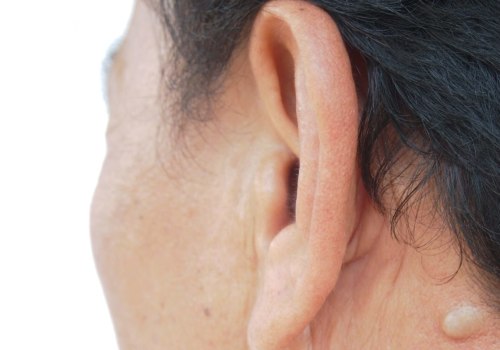 Boil vs Cyst vs Abscess: Quick Guide to Safe Care