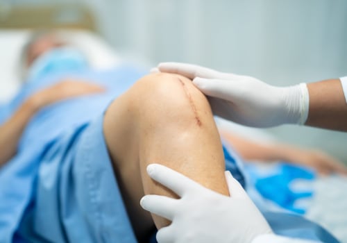 Dissolvable Stitches Healing Stages: See How Recovery Unfolds