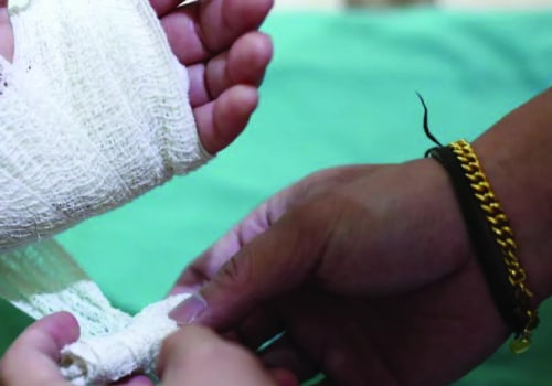 Iodoform Packing Benefits: Does It Really Speed Up Wound Healing?
