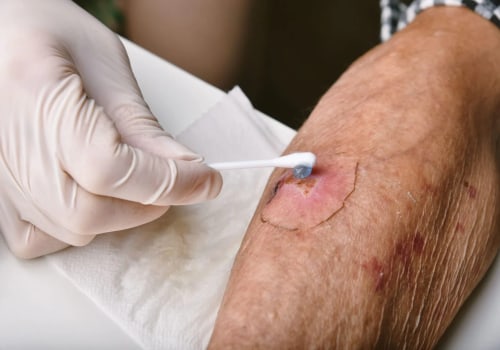 Do Antibiotics for Wound Infection Really Work? Safe Healing Tips